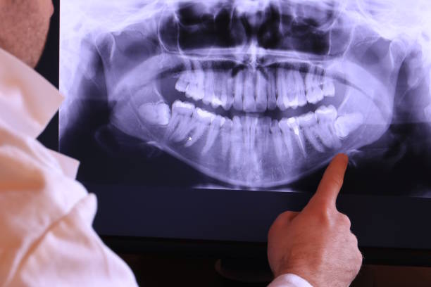 Best Emergency Denture Repair in Steger, IL