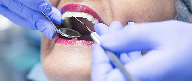 Best Emergency Tooth Extraction in Steger, IL